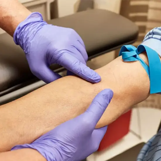 Anti-Thyroglobulin Antibody (ATG)